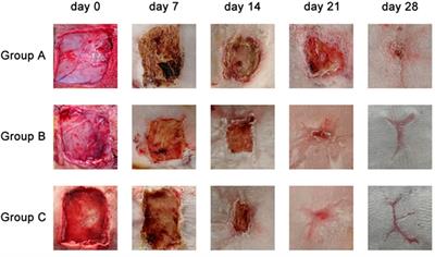 Frontiers A novel wound dressing material for full thickness